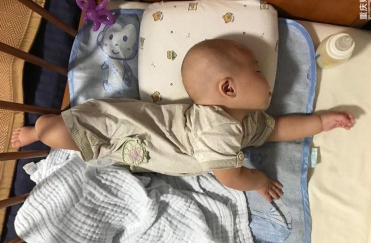 Hành vi ưỡn người là một phản xạ phổ biến ở trẻ nhỏ, có thể do sinh lý hoặc bệnh lý