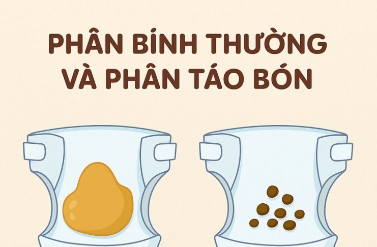 5 Dấu hiệu con táo bón cha mẹ không thể bỏ qua Phân khô, cứng, vón cục như phân dê là dấu hiệu rõ nhất của táo bón ở trẻ nhỏ