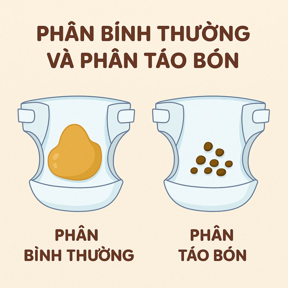 Phân khô, cứng, vón cục như phân dê là dấu hiệu rõ nhất của táo bón ở trẻ nhỏ