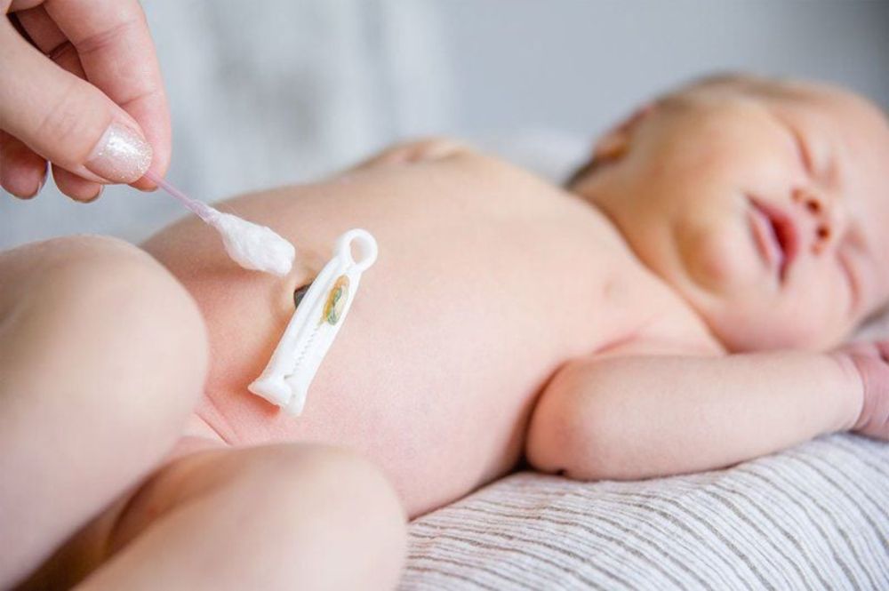 Nhận biết sớm các dấu hiệu bất thường ở rốn giúp bé được điều trị kịp thời và tránh biến chứng